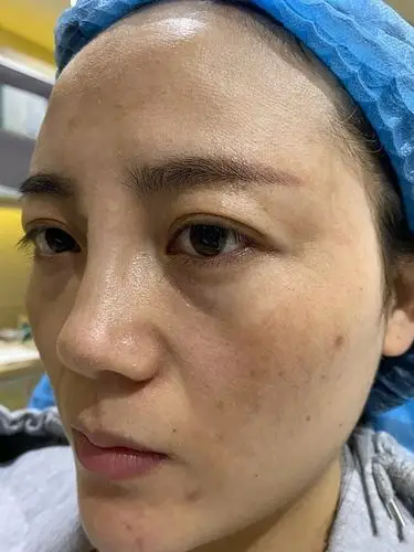 打泪沟的第一天