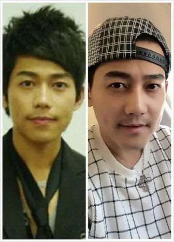 苏醒一定削骨 做鼻子了!新图更新对比!