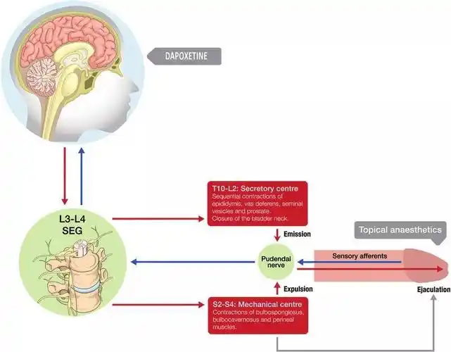 如何用飞机杯做延时训练? - 知乎