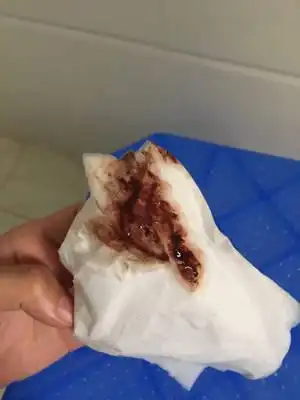 今早突然流了很多褐色分泌物,肚子并不痛,已经去医院检查过,确定怀孕