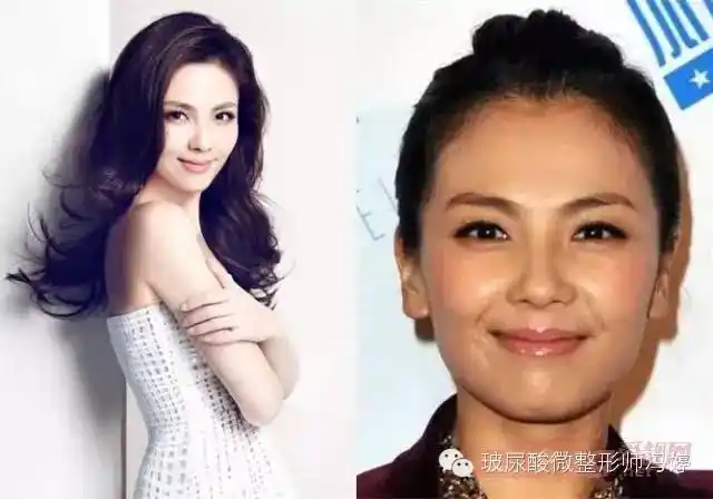 刘涛整容前后照片是真是假刘涛整容真相