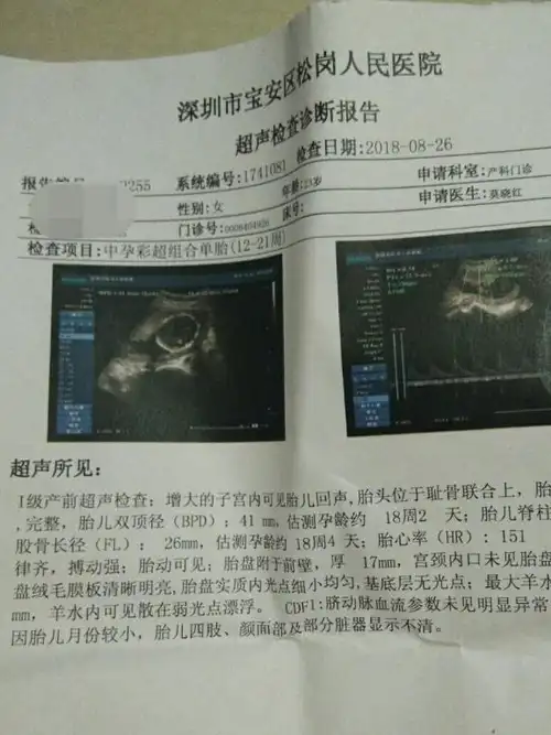 如何看懂产检b超单?宝妈手把手教你_宝宝_胎盘_情况