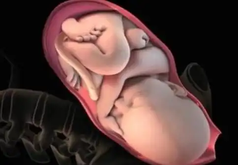 宝宝入盆其实在怀孕最后几周的时候,医生就会叮嘱孕妇注意身体的钢种