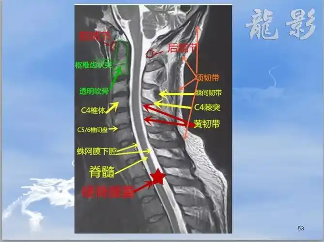 核磁共振和脊柱解剖