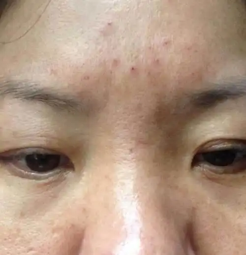 事业运是好还是坏首先来说,面相中出现山根有横纹并非一定意味着其人