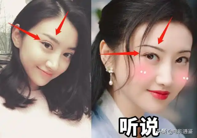 有一说一,景甜在拍《司藤》之前抽掉了双眼皮线,她的确是做了一个很