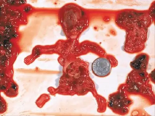 母亲:「婴儿为生存奋斗,喘不过气来,到处抽动乱移,使母亲难忘,在观看