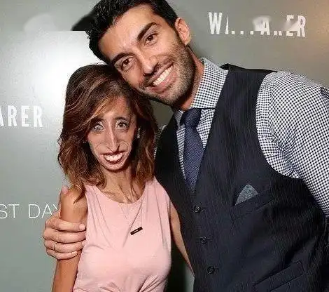 全网攻击的世界最丑女人竟鼓舞千万人我的存在就是上帝的美意