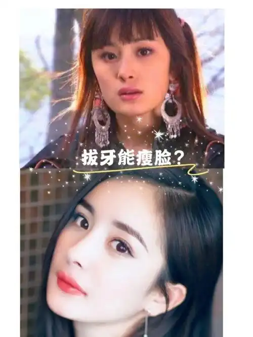 杨幂在采访的时候告诉大家,拔智齿可以瘦脸,但是真的如此吗?