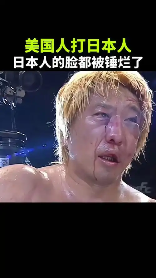 美国选手暴揍日本选手,日本选手的脸都被打成了猪头