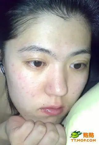 皮肤不好怎么办我有图片