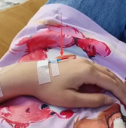 虽然输液回血对身体伤害性不大,但是有的玩笑还是不要开.