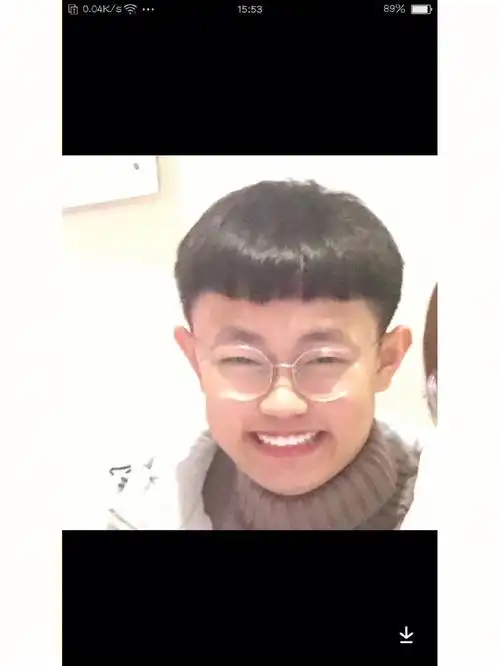 儿子和维维啊同款耳朵9099#招风耳吗