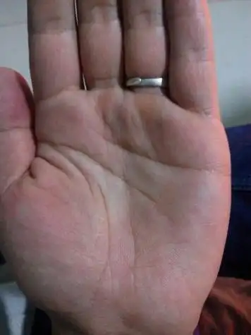 我生命线是断的!今天看手相的说我短命!