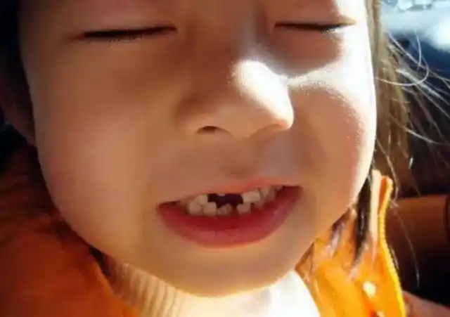为什么孩子会长"双排牙"?医生:原因有3个,父母要重视