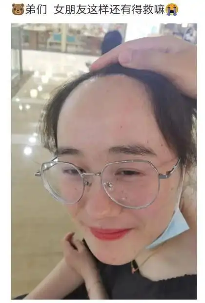 我发现发际线高的人,一般都比较聪明,要学会珍惜!_网易订阅