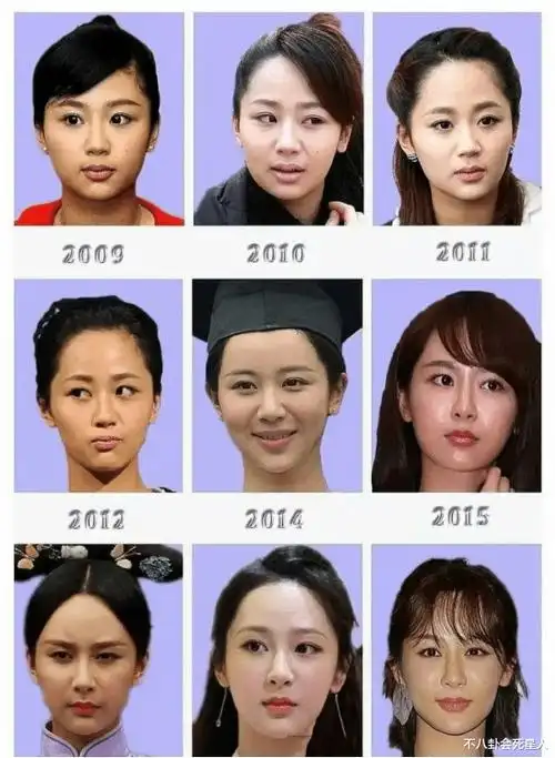 坚持不承认整容的明星,看完对比图,我只想说:别把观众当傻子