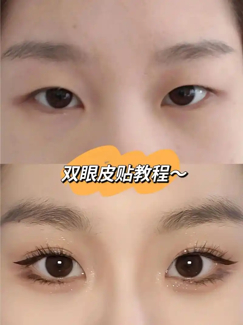 单眼皮|超详细双眼皮贴教程来咯… .单眼皮|超详细双眼皮贴教 - 抖音