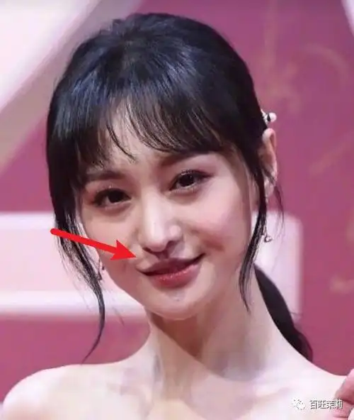 位于法令纹下方与嘴角上方,略显塌陷的一条地带,在很多明星脸上都见过