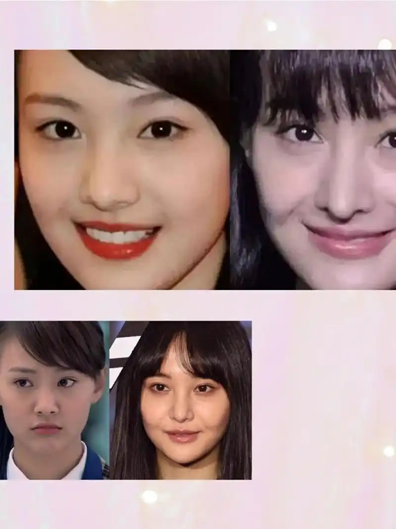 郑爽整容真是娱乐圈一大惨案