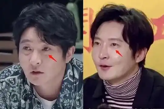 不得不说,做完眼袋手术的郭京飞年轻了许多.