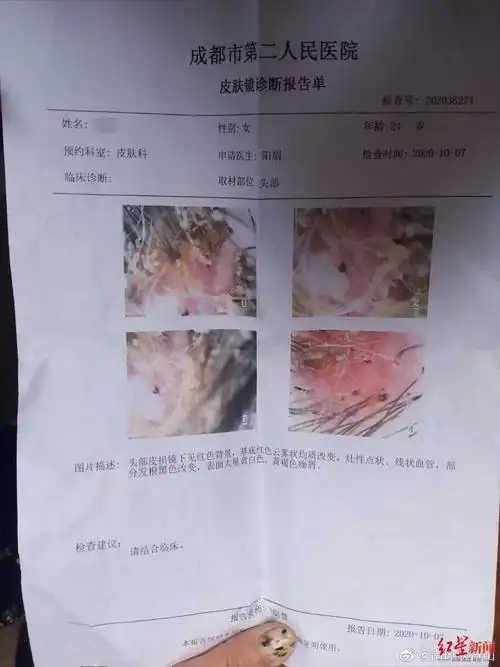 吴小姐去二医院皮肤病医院就诊时的报告