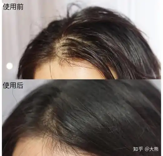 控油洗发水哪个比较好女生控油蓬松的洗发水推荐好用的控油防脱洗发水