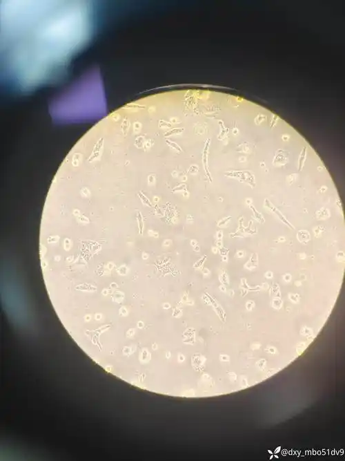 慢病毒感染后细胞状态变差,死亡 - 丁香园论坛