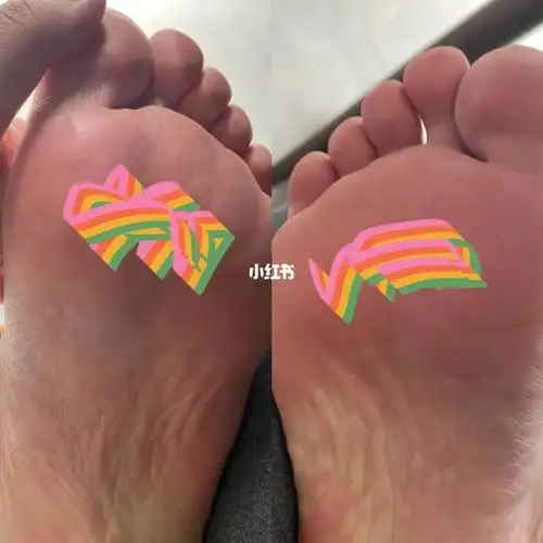 也痛,我查了下反射区是斜方肌还是肾脏国庆节每天让老公给我按摩两次