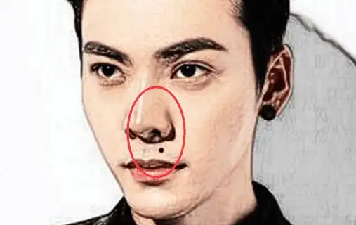 身上四处发财痣,一定不能点,发家致富必备!