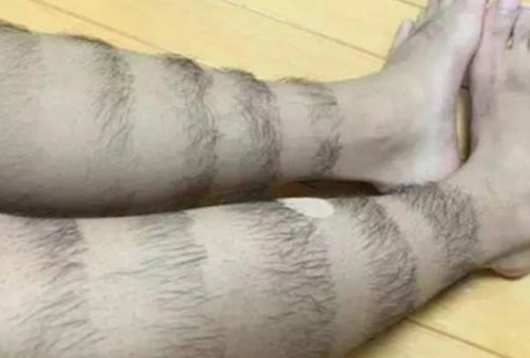 为什么有的男性腿毛"浓密",有的却白白净净?腿毛浓密说明了啥