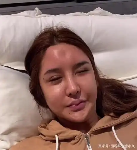 网红桃花宝宝整容失败,额头后遗症明显,曾经发问网友是不是嫉妒