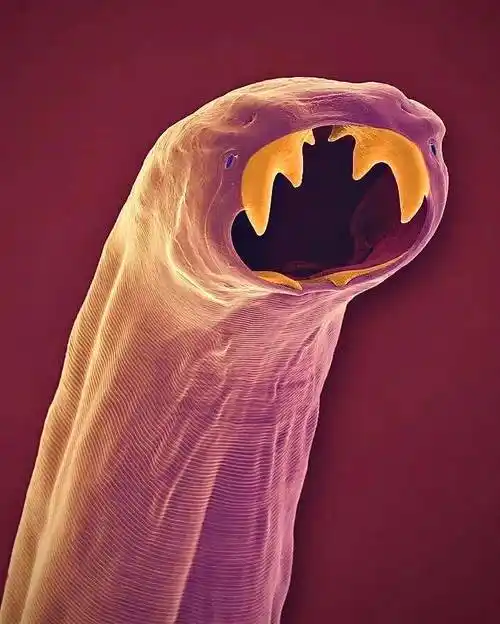 小小的微生物放大了竟然如此可怕-显微镜下的微型生物_图像_细菌_深海