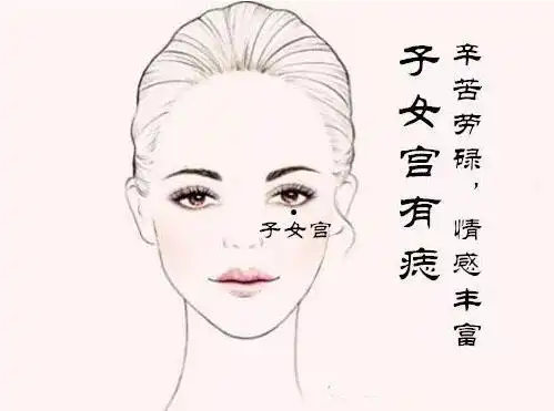 最影响女人幸福的五颗痣,最好想办法化解!