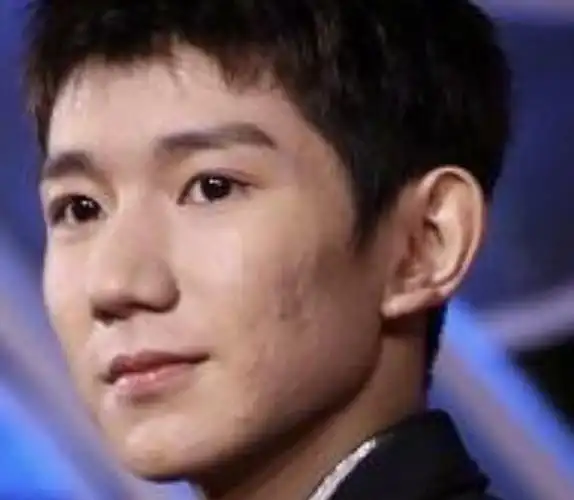 原创王源无美颜生图被疯传镜头拉近后皮肤坑坑洼洼确定这是18岁