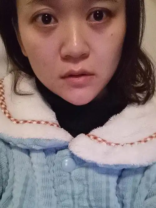 28岁这样的皮肤状态算不算很差