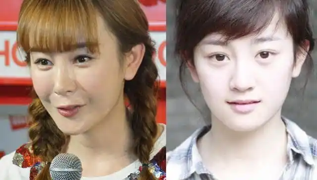 那些不接受自然老去的女明星整容后遗症明显