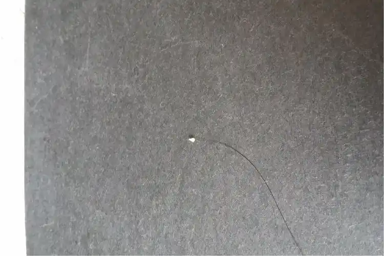 脂溢性脱发掉的发根图片