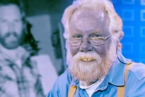 蓝种人是否真实存在真实存在基因存在缺陷