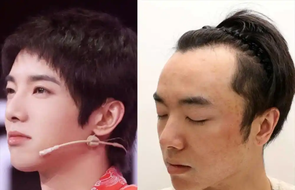华晨宇被曝整容植发,知情人晒出大量视频和照片,对比之下太明显
