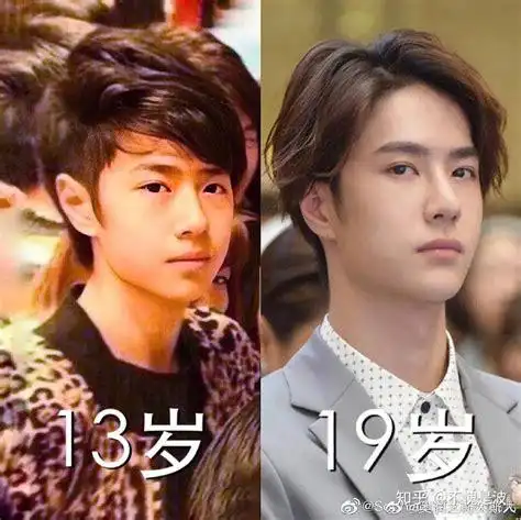 王一博下巴整容王一博整容前后2022已更新今日热点