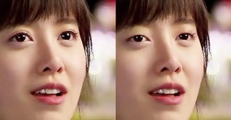 双眼皮与单眼皮哪个好?后悔太晚知道了!