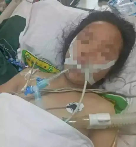 上山割草遭五步蛇偷袭,女孩昏迷三天,结果