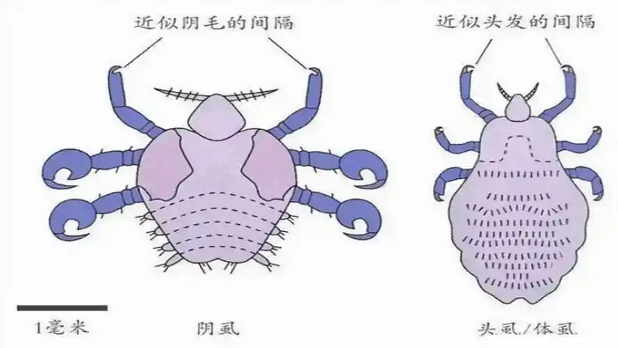 虱子在进化的过程中分成了三种,阴虱,体虱和头虱,它们占据着人身体的