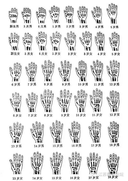 骨龄测评你真的都搞定了吗