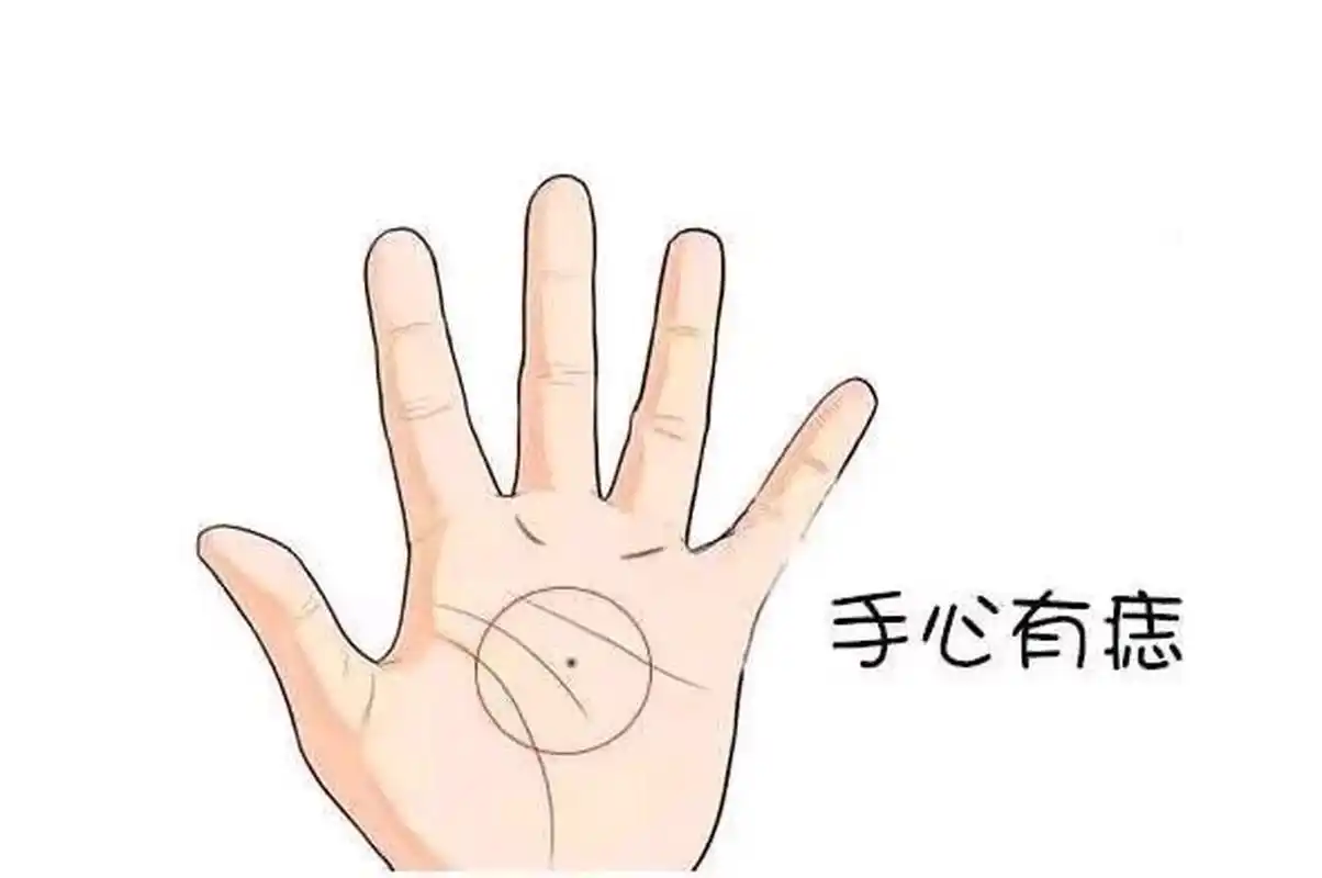 手掌有痣  手掌的痣一般都是属吉痣,手掌心的痣代表智且富,代表你很