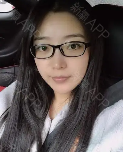 我的优点就是好看,缺点就是近视.