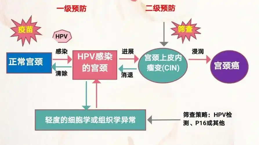 宫颈癌_宫颈癌如何预防 - 好大夫在线