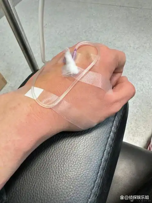 10月6日 ,黄晓明在个人社交平台晒出自己在医院输液的照片,令粉丝无比