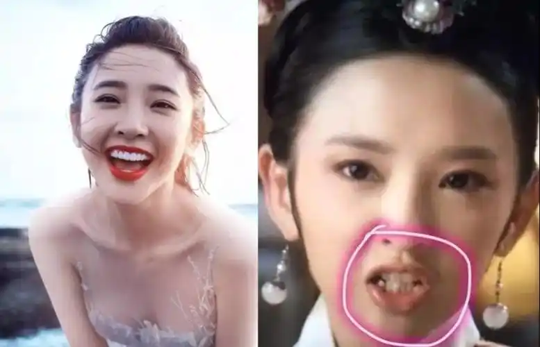 又大又白的牙真的适合每一个人么-牙齿又白又大好吗 - 114知识网